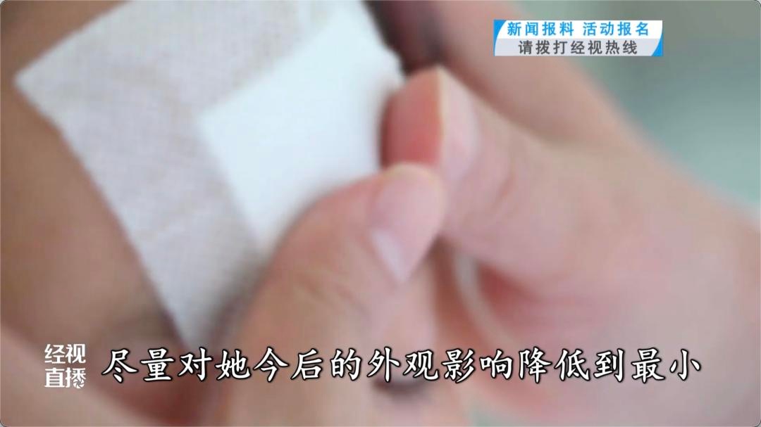 8岁女童骑车跌落命悬一线！牙齿呛入支气管如何化险为夷？  第5张
