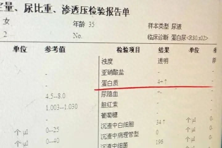 追求美白却汞中毒？警惕这些美丽陷阱！你还敢随便用美白产品吗？