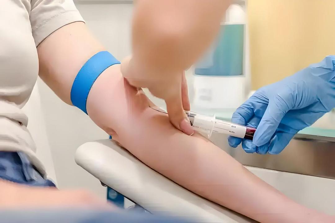 艾滋病竟是职业病？你所不知道的艾滋病病毒职业暴露  第2张