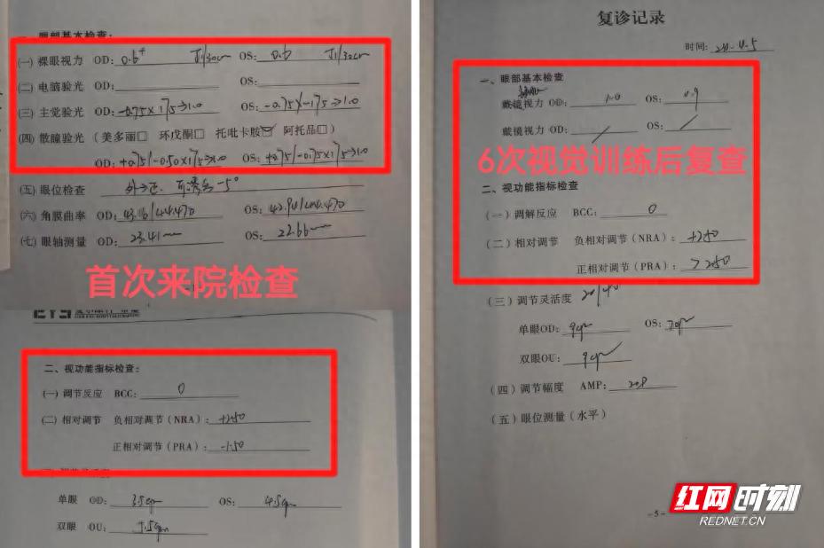 8岁孩子视力堪忧！家长揪心：难道小小年纪就要戴近视镜？